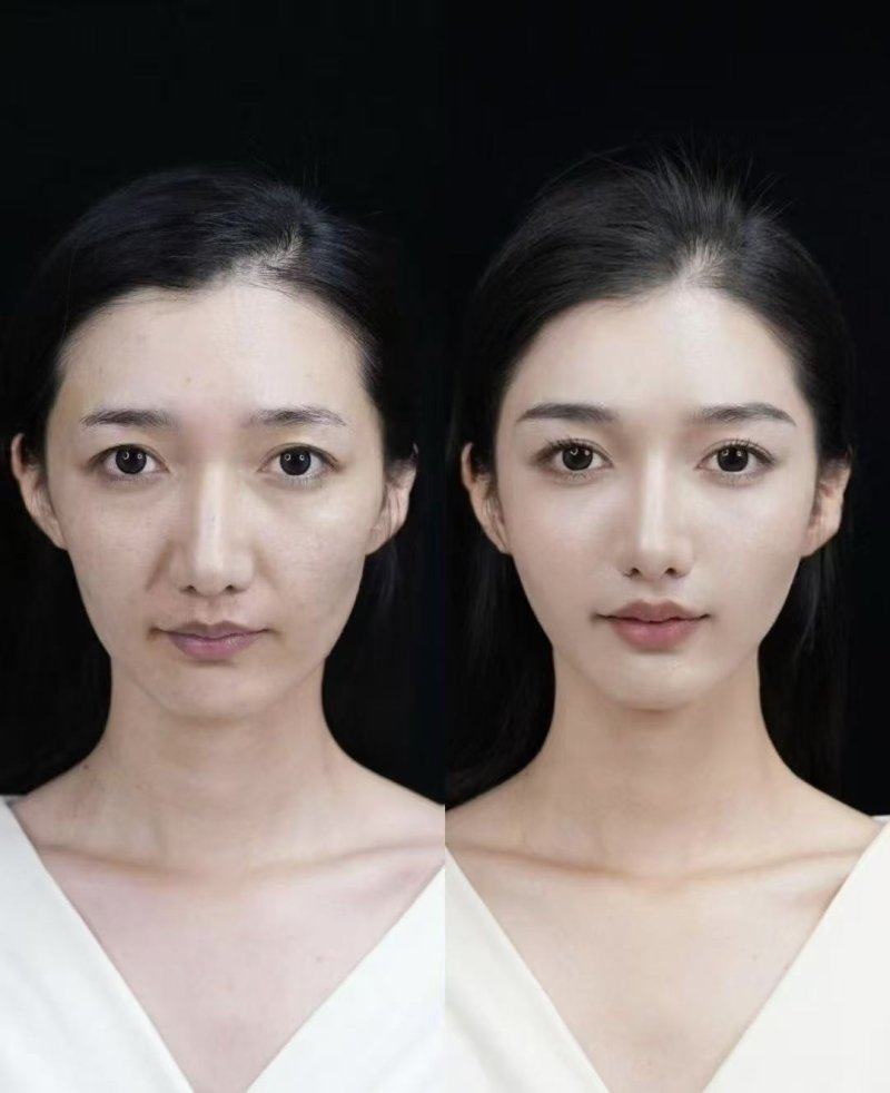 宁夏银川崔大夫医疗美容预约挂号方式