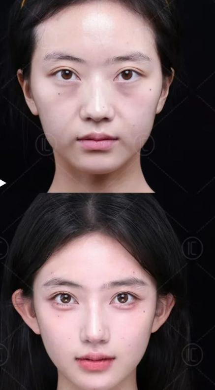 詹繁荣医生技术优势