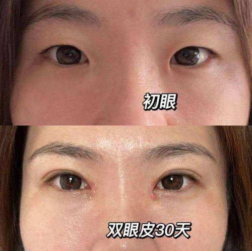 宁世双医生怎么预约