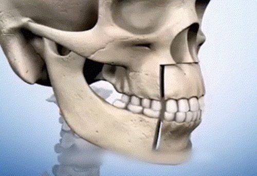 北京圣爱整形美容医院预约挂号方式：