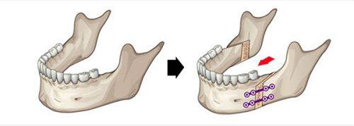 沈阳市朝鲜族医院美容外科口碑评价