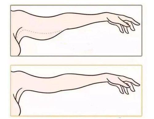 六、行业避坑提醒