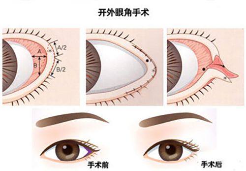 二、不同类型面部疤痕的针对性修复方案