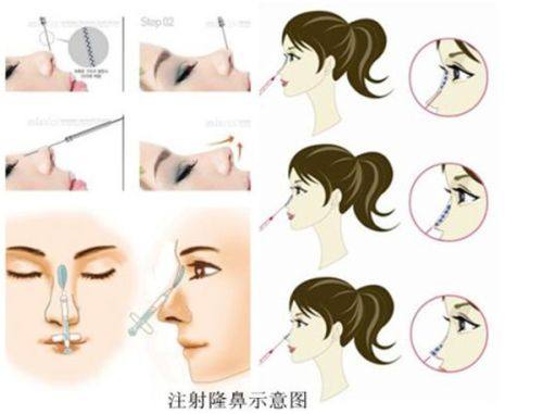 北京圣爱整形美容医院怎么样？