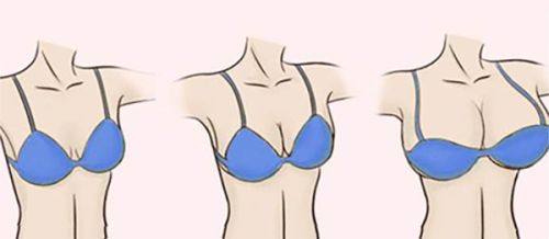 四、不同维持需求下的隆鼻方案选择