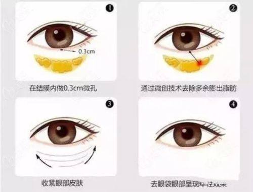 北京圣爱整形美容医院口碑评价：