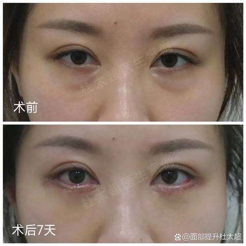 上饶市皮肤病性病防治所整形美容中 心口碑评价