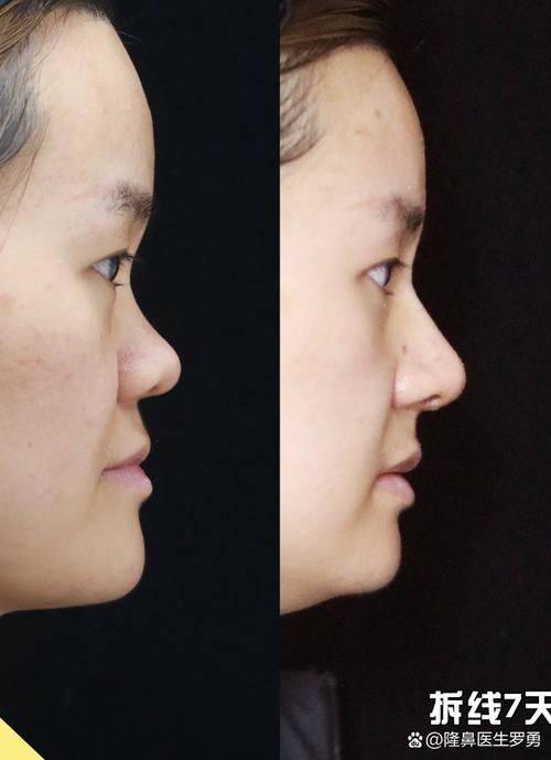 石家庄诺万医疗美容医院地址电话及营业时间：