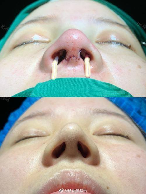 陳翰儒医生技术优势：