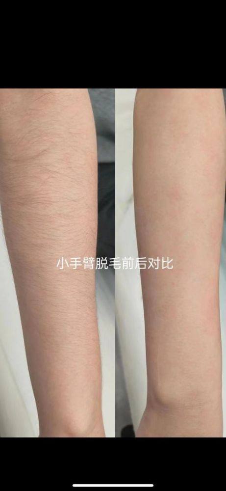 武汉明星医整形医院口碑评价：