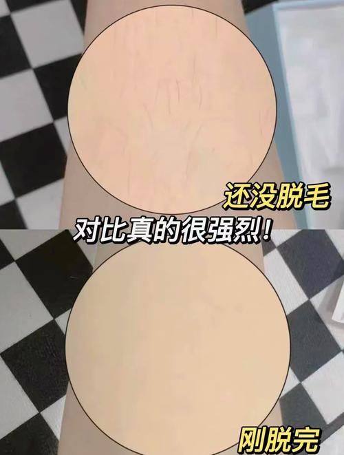 石家庄诺万医疗美容医院预约挂号方式：