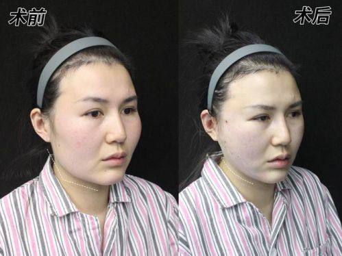 沈阳市朝鲜族医院美容外科擅长项目