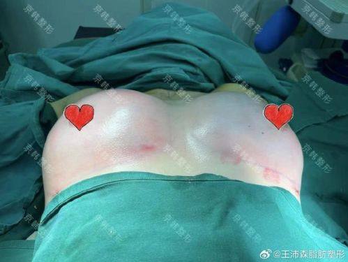 朝阳涵美荟整形医院地址电话及营业时间