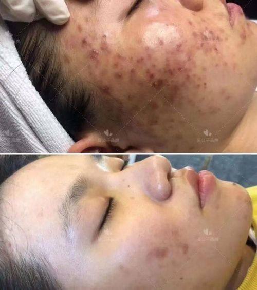 石家庄诺万医疗美容医院怎么样？