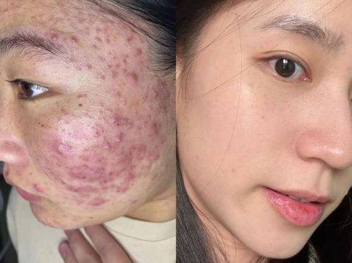 南阳金博整形医疗美容诊所价格表：