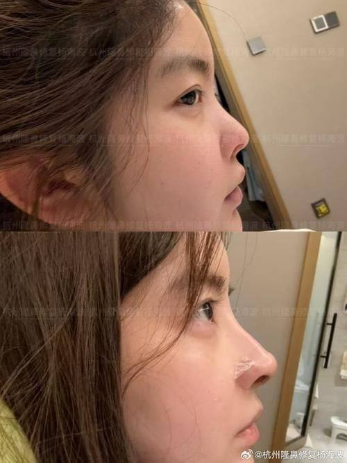 上饶市皮肤病性病防治所整形美容中 心预约挂号方式