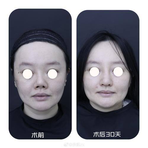 常州德尔美客整形医疗美容门诊部价格表