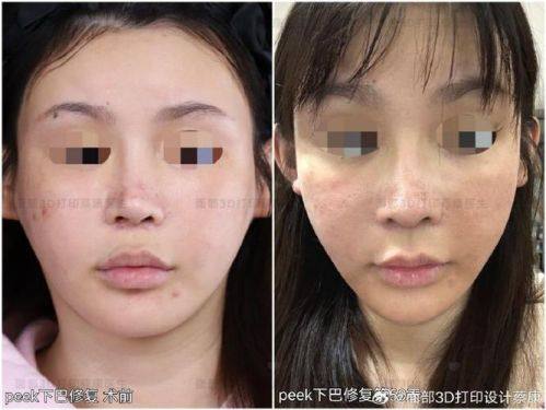 沈阳市朝鲜族医院美容外科医生名单及擅长领域：