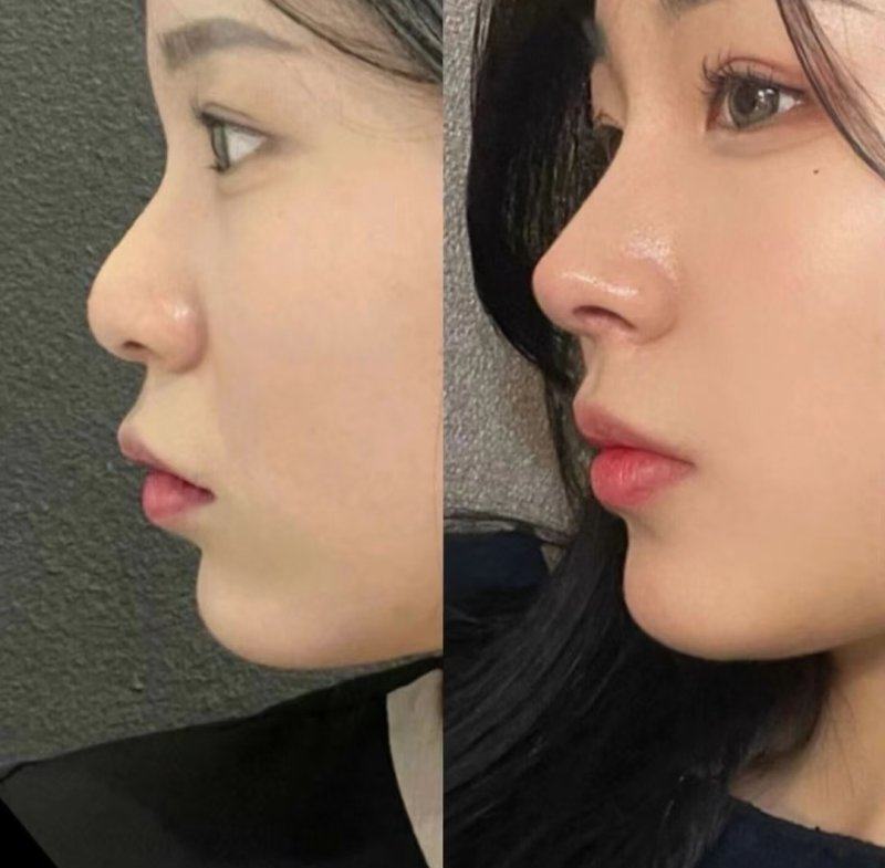 沈阳市朝鲜族医院美容外科怎么样？