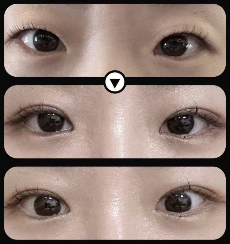 上饶市皮肤病性病防治所整形美容中 心怎么样？