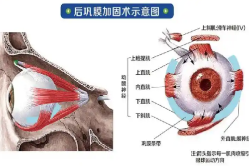 三、眼袋有细纹了怎么消除