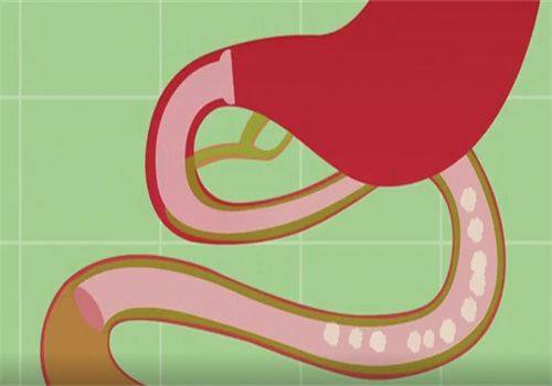 结尾：科学应对全切双眼皮肉条问题