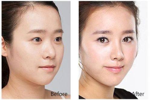 襄阳伊尔美丽整形美容门诊部预约挂号方式：