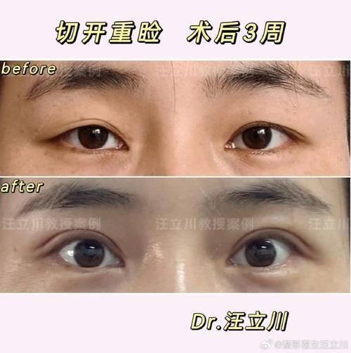 肇庆宝柏时光整形医院地址电话及营业时间：