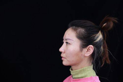 马秀伟医生怎么预约