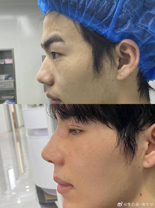 汉中仁爱医院预约挂号方式