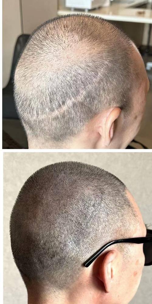 肇庆宝柏时光整形医院口碑评价：