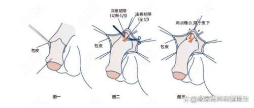 马秀伟医生技术优势