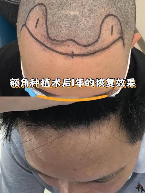 肇庆宝柏时光整形医院怎么样？