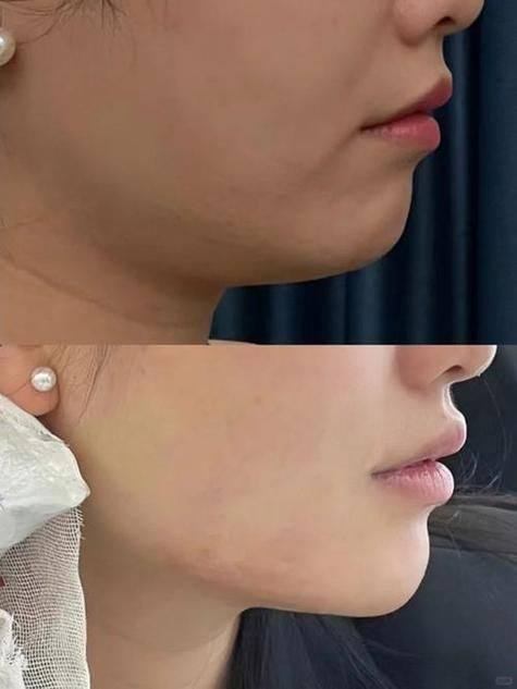 遂宁伊莎贝拉整形医学美容门诊部擅长项目