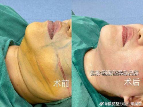 襄阳伊尔美丽整形美容门诊部地址电话及营业时间：