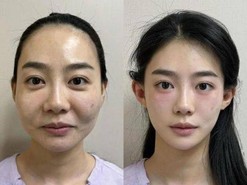 北京善之美医疗美容整形医院擅长项目