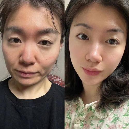 金容燮医生技术优势