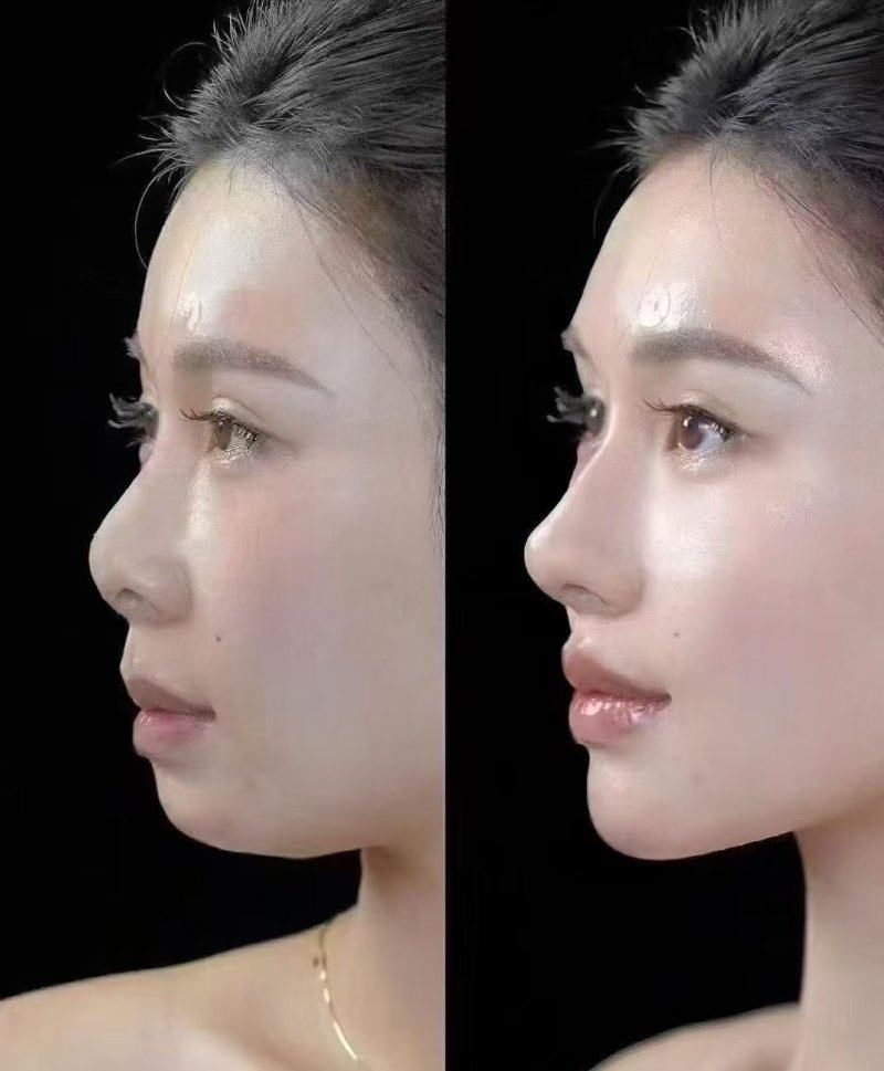 徐源弘医生口碑评价