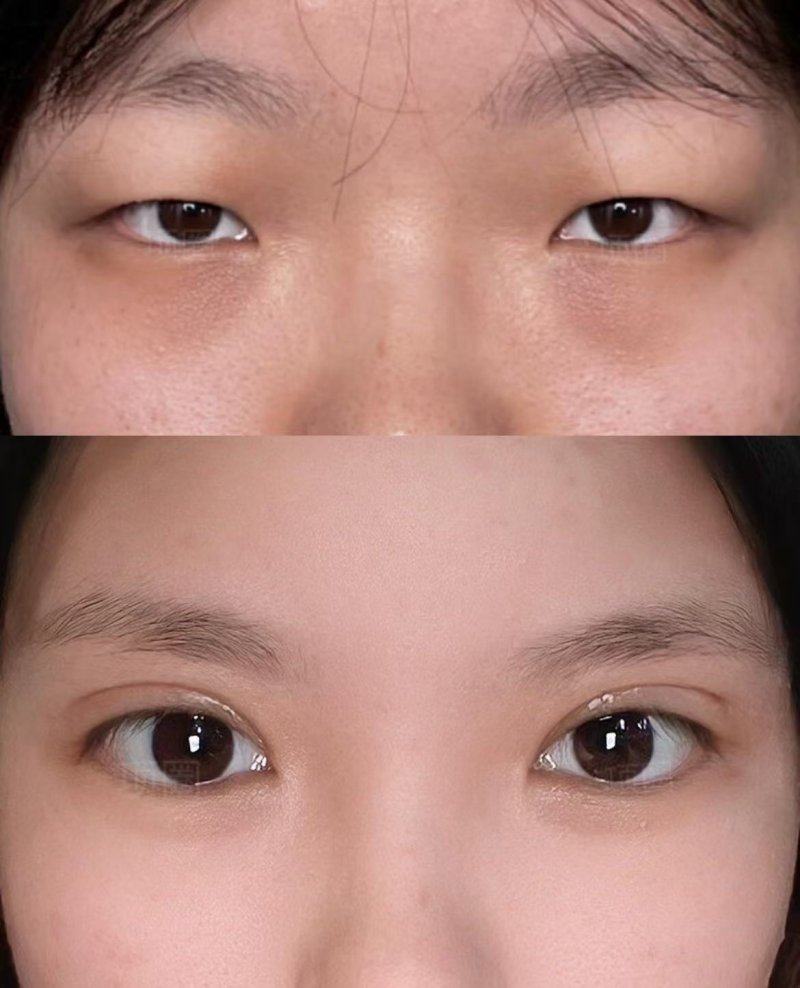 韩国V整形医院口碑评价：