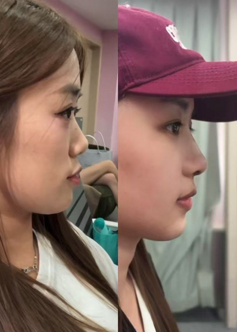 红妆双美整形美容医院价格表