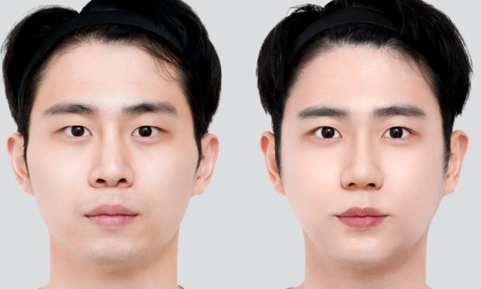 徐源弘医生怎么预约