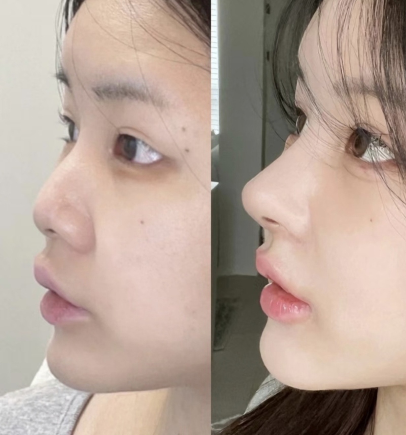 三、真假肉条的区分方法