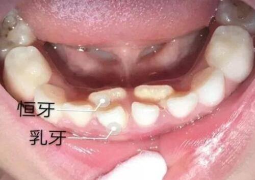 四、使用药膏的注意事项