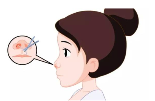 李健刚医生怎么预约