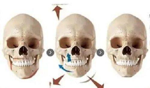 四、埋线失败修复抽线的全新临床方案