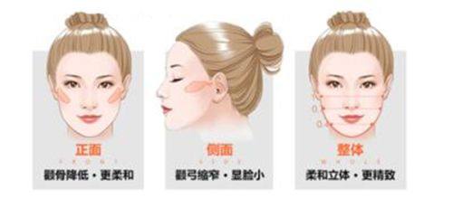 五、如何有效规避衡力瘦脸针面部凹陷风险