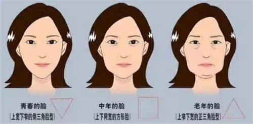 三、双眼皮埋线取线麻烦吗?至佳抽线时机是什么时候