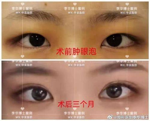 深圳芙娜伊美整形医院怎么样？