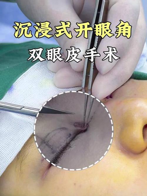 深圳芙娜伊美整形医院预约挂号方式：