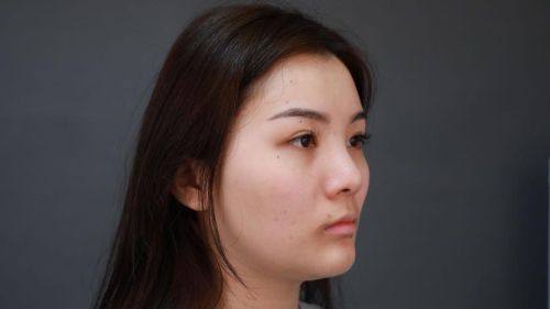 张东勤医生怎么预约?